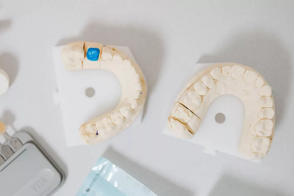Dental Wax: An Indispensable Ally in Oral Comfort and Dental Procedures
